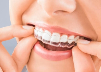 Aligners
